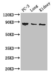 CARS Antibody