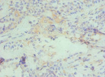 CBX4 Antibody