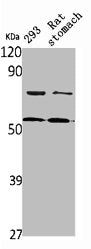 DFNA5 Antibody