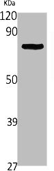 NEFL Antibody