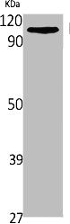 SLC8A1 Antibody