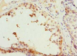 CCNE2 Antibody
