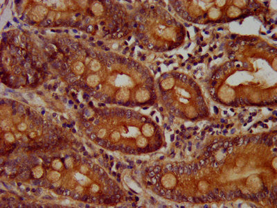 CCS Antibody
