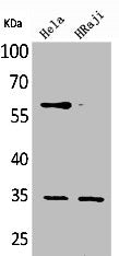 FCGR2B Antibody