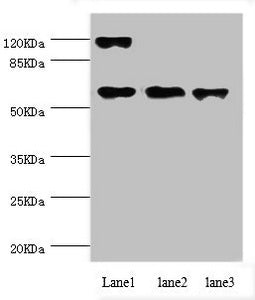 CCT5 Antibody