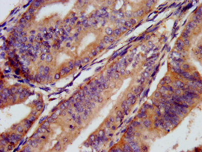 CD1E Antibody