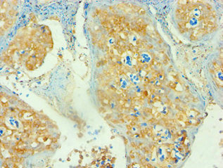 CD3D Antibody