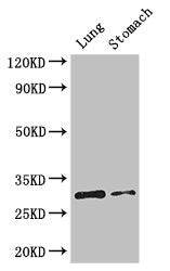 CD40 Antibody