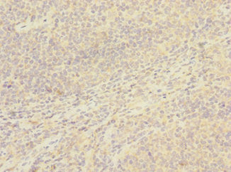 CD8B Antibody