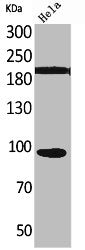 NTRK3 Antibody