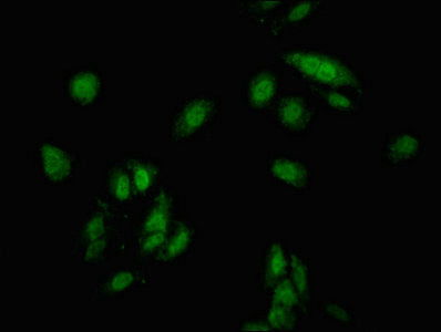 CDKN1C Antibody