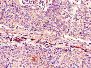 CDKN2A Antibody