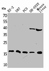 IL1B Antibody