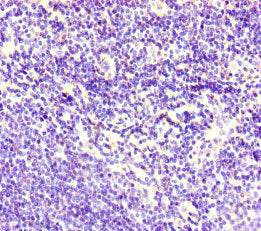 CDSN Antibody
