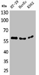 CYP11B1 Antibody