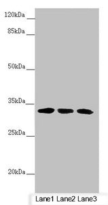 CENPK Antibody