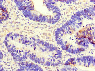 CEP290 Antibody