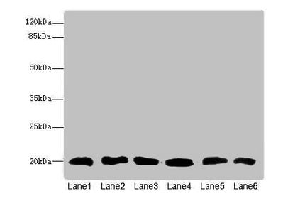 CFL2 Antibody