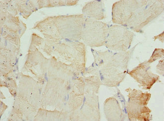 CFL2 Antibody