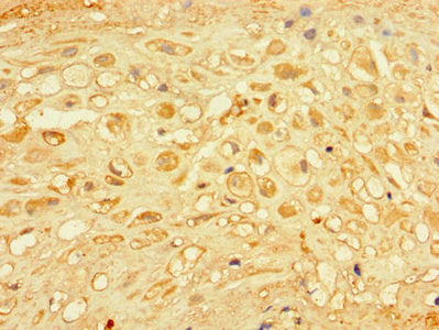 CHM Antibody