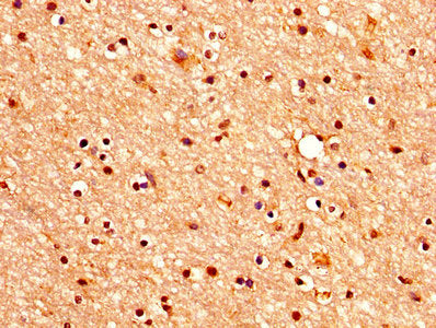 CHRM3 Antibody