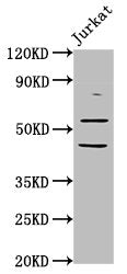 CHRNB2 Antibody