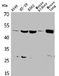 GDI2 Antibody