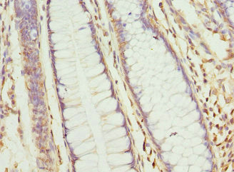 CLCN7 Antibody