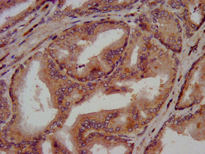 CLN5 Antibody