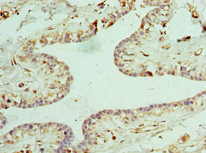CLTA Antibody