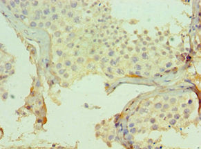 CMA1 Antibody