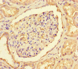 CNOT1 Antibody