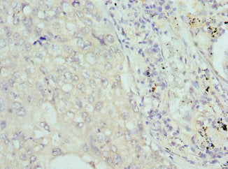 COCH Antibody