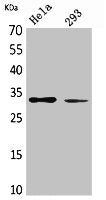 SDHB Antibody