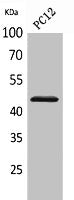 IL1R2 Antibody