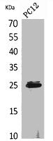 CMTM5 Antibody