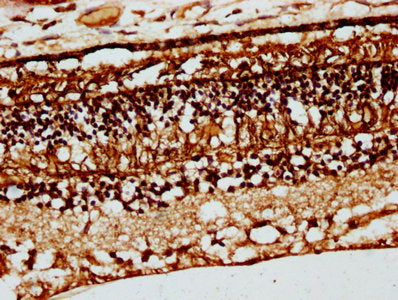 CRB1 Antibody