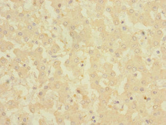 CRLF2 Antibody