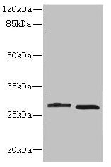 CRYBB1 Antibody