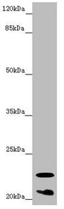 CRYGS Antibody