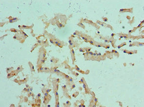 CST1 Antibody