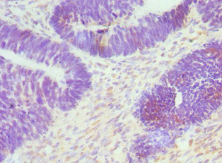 CTCF Antibody