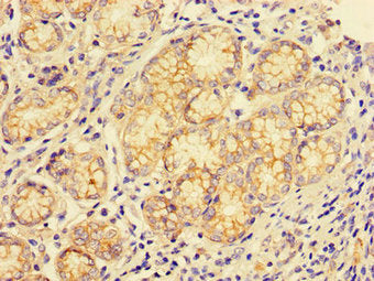 CTSE Antibody