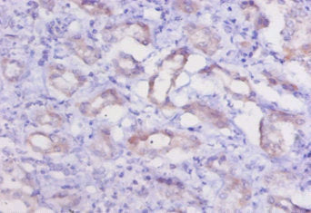 Ctsk Antibody
