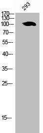 PTGFRN Antibody