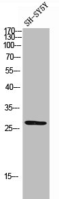 Phospho-TNNI3 (S22/S23) Antibody