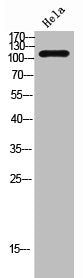TNNI3 Antibody