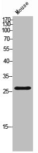 TNNI3 Antibody