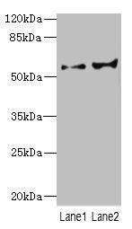 CYP2C18 Antibody