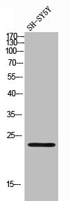 CDKN3 Antibody